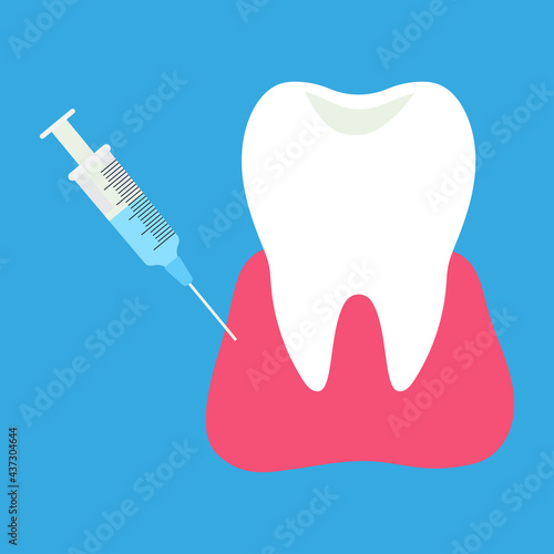 injection of anesthesia for treatment of tooth