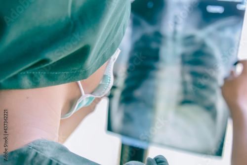 Obraz na płótnie Doctor checking examining chest x-ray film of patient at ward hospital