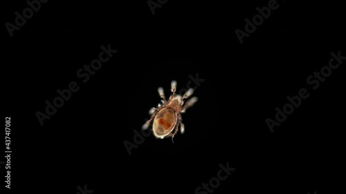 mite (acari) Oribatida under microscope are saprophago, scavengers, some species of predators, order Sarcoptiformes. Live in the soil photo