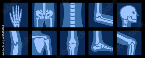 X-ray of bones. X-rays examination of human joint anatomy. Medical, educational and science illustration.