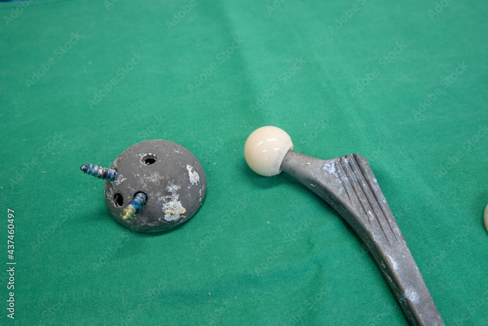 explanted hip prosthesis lies on a green surgical drape
