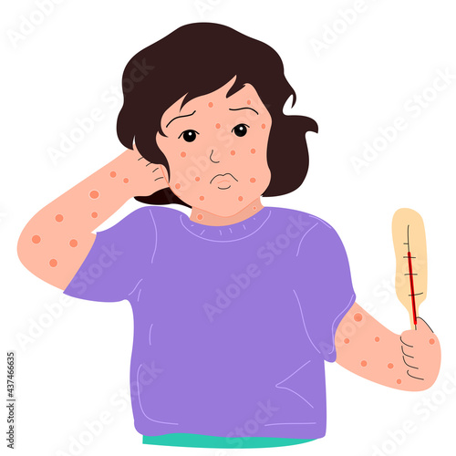 A girl with chickenpox and a rash all over her body.