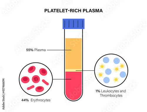 Platelet rich plasma concept