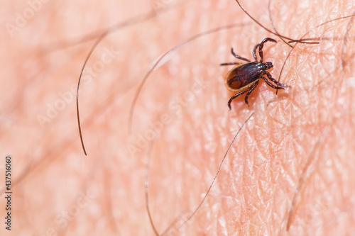 A tick crawls on human skin. A closeup of a tick. A photo with a shallow depth of field.