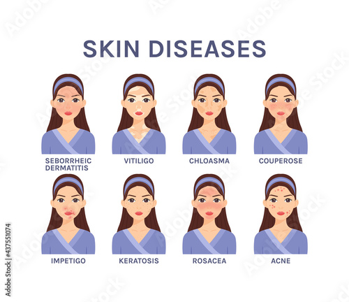 Skin Diseases. Beautiful woman with face skin problems. Flat cartoon color style. White background. Vector stock illustration.