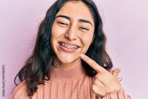Hispanic teenager girl with dental braces showing orthodontic brackets smiling happy pointing with hand and finger