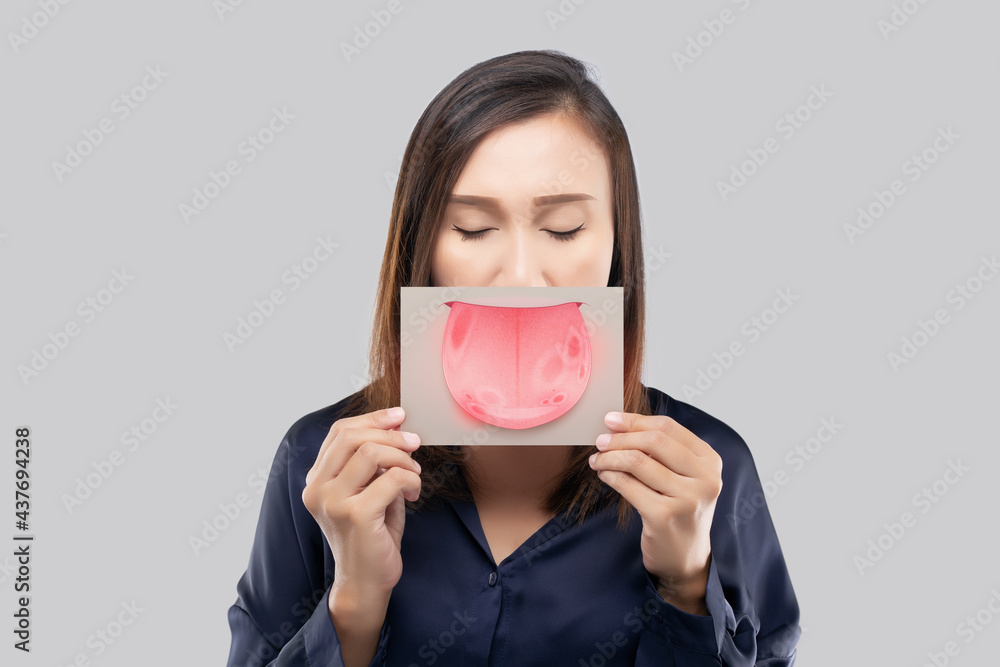 The woman show the picture of tongue problems, Illustration benign migratory glossitis on a brown paper, Behcet's Disease The woman show the picture of tongue problems, Illustration benign migratory glossitis on a brown paper, Behcet's Disease