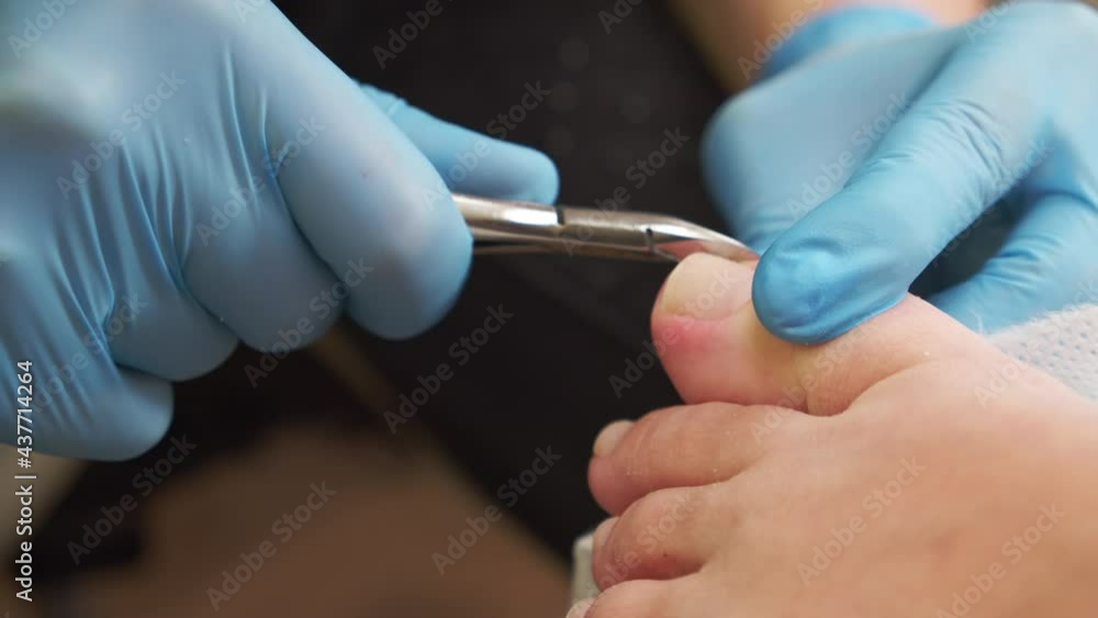 Processing of rough cuticles of nails on leg with a nail nipper. Nails care process in nail salon. Manicurist removing cuticles on big toe. Process of pedicure in a beauty salon.. Processing of rough cuticles of nails on leg with a nail nipper. Nails care process in nail salon. Manicurist removing cuticles on big toe. Process of pedicure in a beauty salon..