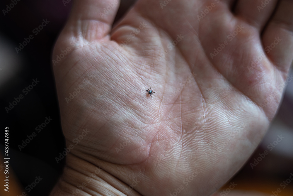 Fototapeta premium tick moving on human body