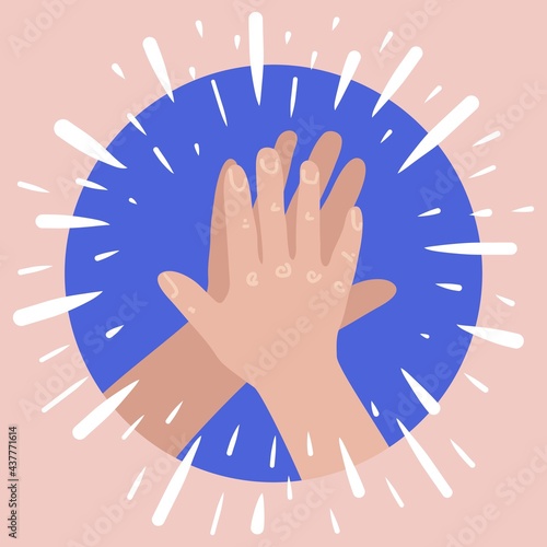 High five hands. Two hands giving high five. Success teanwork concept.