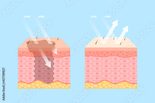 Human skin protection from ultraviolet rays effect. Realistic design for skincare spf sunscreen cosmetic product packag. Medical cream with solar reflection before and after apply vector illustration