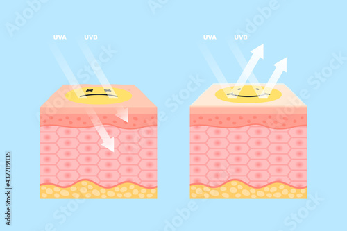 Skin health ultraviolet rays protection with uv filter and without. Sunblock cream and uv sunscreen spf body lotion creative humor design for cosmetic product packaging vector illustration