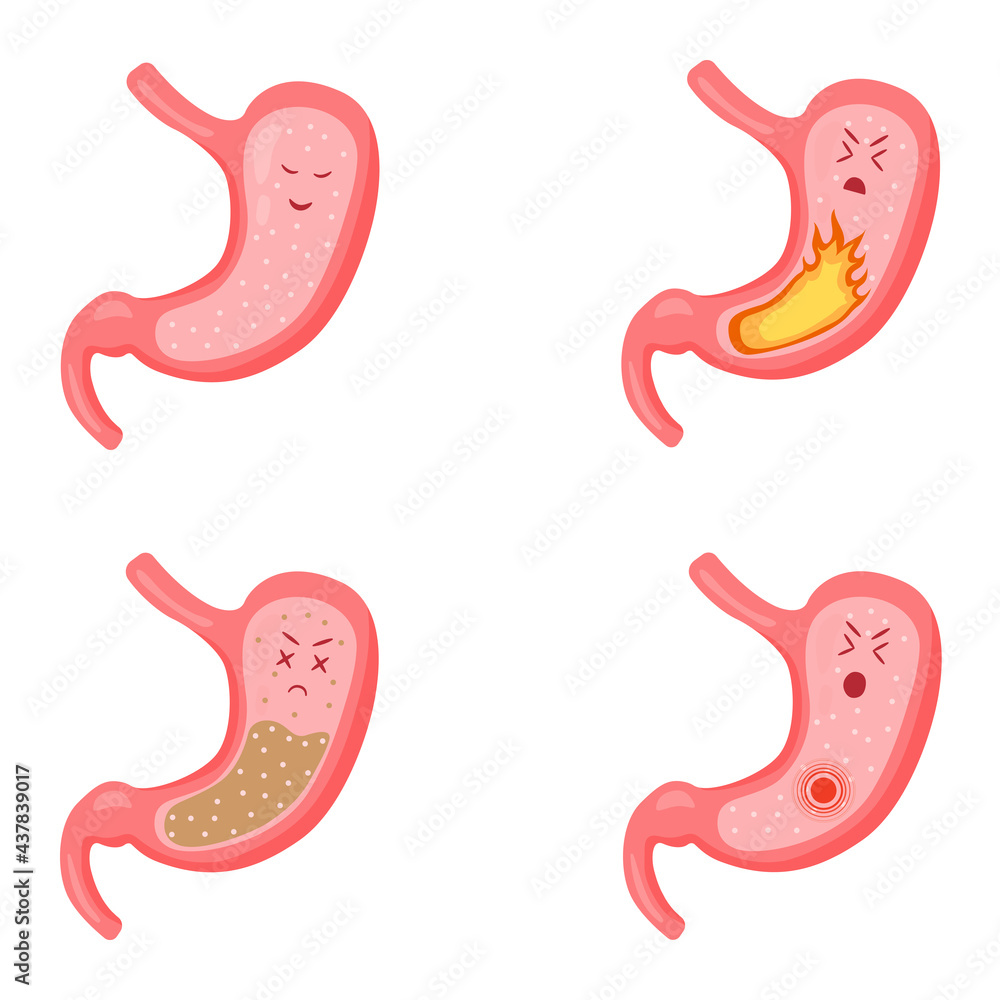 Fototapeta premium stomach healthy stomach sick set dd ww