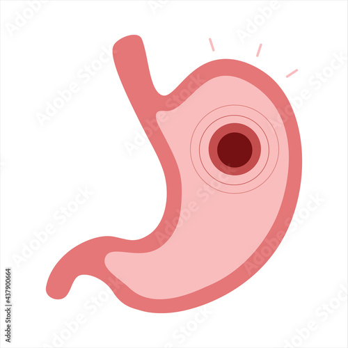 Bloating, stomach trouble. Vector flat cartoon illustration on white background