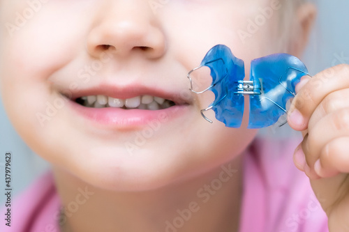 Dental plate. Expansion of the jaw in a child. A plate to heaven. There is not enough room for the molars.