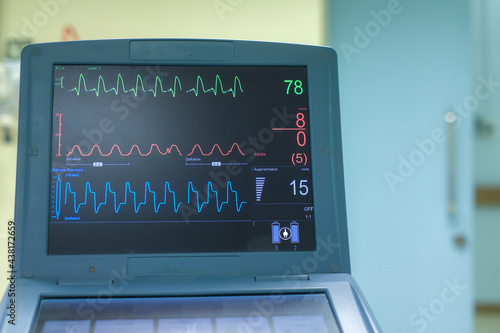 EKG monitor in intra aortic balloon pump machine. Medical equipment.  © Koragot kaewmahakhun
