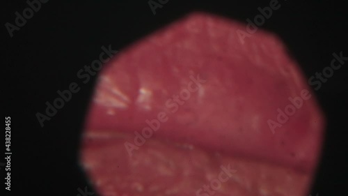 Teeth enlargement, view through the eyepiece. Observation of the eyes in a shark. Microscope view of teeth examination during treatment and whitening.  photo