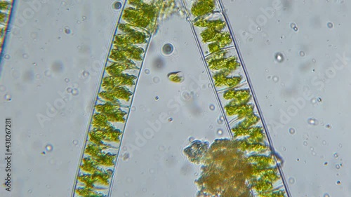 Respiration of microorganisms under a microscope. Absorbed carbon dioxide, oxygen production. Air bubbles in the microcosm photo