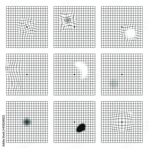 Amsler grid scotoma eye test.  Oculist Vector printable chart retina examination. Grid with dot in centre. Vision control.