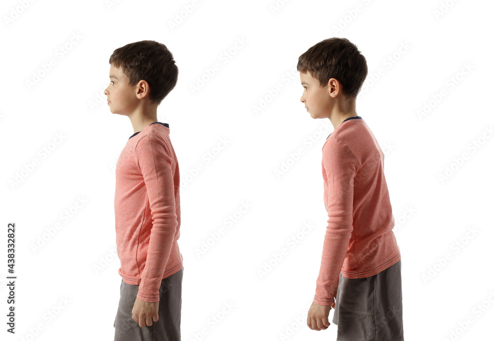 Little boy with proper and bad posture on white background - obrazy, fototapety, plakaty 
