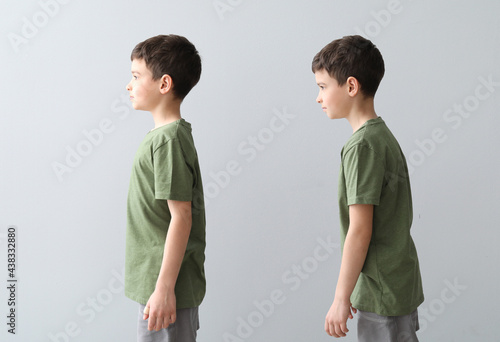 Little boy with proper and bad posture on grey background