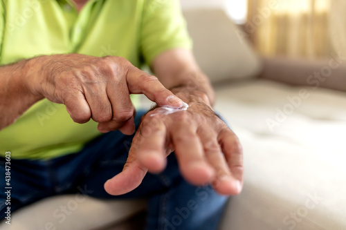 Photo of a mature male hands put on a hands cosmetic cream. Man applying moisturizer cream on hands, dry skin. Dermatology, cold weather skin care concept.