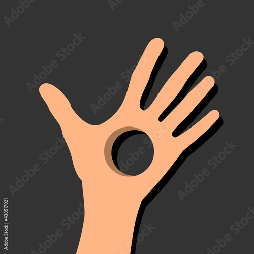 Holey hand - hand with hole in the palm. Defect, disability and handicap of disabled and handicapped human body. Vector illustration.