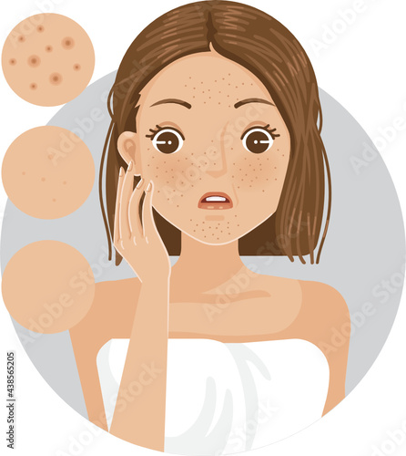 oily skin face of girl  cheek and oily skin on face and nose on woman