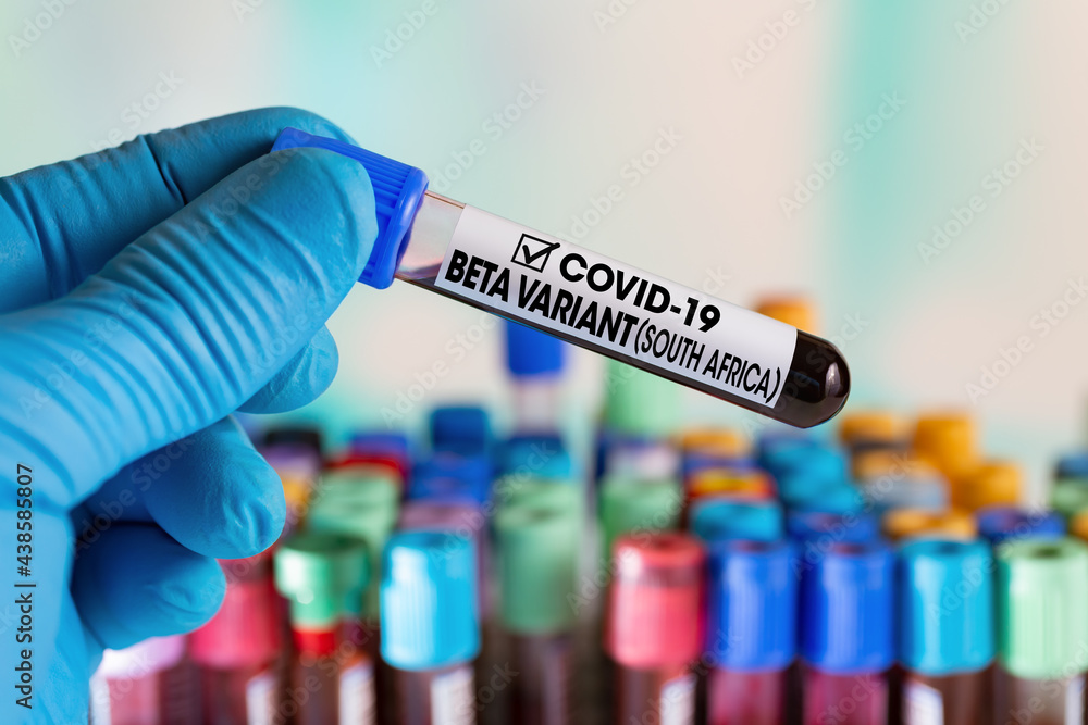 Doctor with a positive blood sample for new variant detected in South Africa of coronavirus strain called BETA. Technician holding tube of blood test identified with label Covid-19 BETA Variant Doctor with a positive blood sample for new variant detected in South Africa of coronavirus strain called BETA. Technician holding tube of blood test identified with label Covid-19 BETA Variant