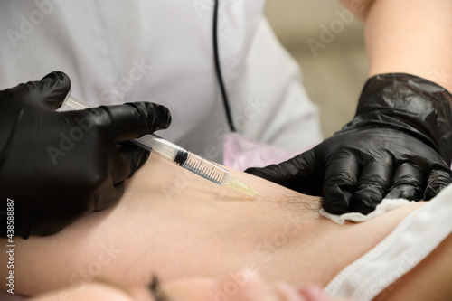 Doctor electrologist gives an injection of anesthesia into the armpit before the electrolysis procedure. Close up.