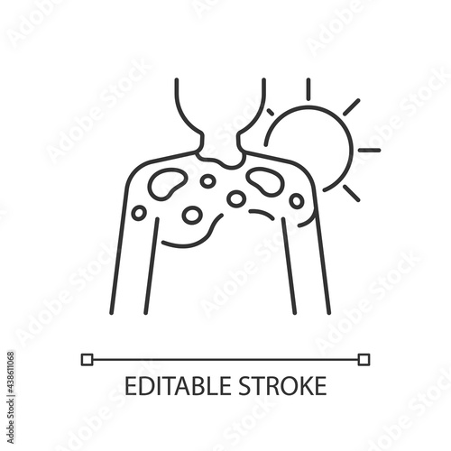 Peeling skin linear icon. Sunburn from excessive sun exposure. Ultraviolet rays damage to body. Thin line customizable illustration. Contour symbol. Vector isolated outline drawing. Editable stroke