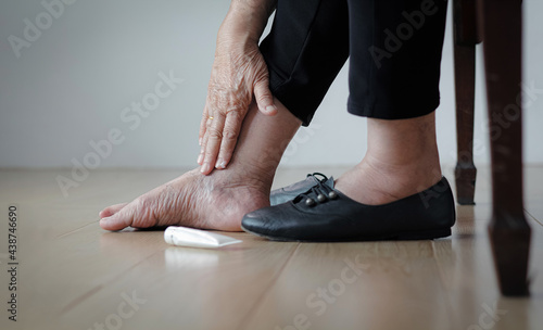 Fotografie, Obraz Elderly woman putting cream on swollen feet before put on shoes