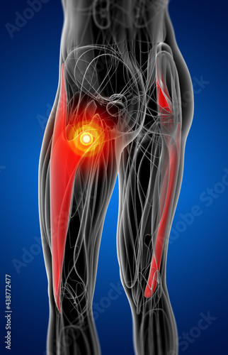 medical  illustration of the  tensor fascia lata