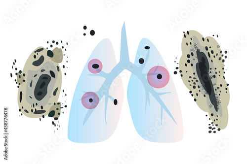 Human's lungs with fungi Aspergilloma Black mold colonies, allergenic black mildew spots, dark fungus colonies isolated, wall mouldiness, mustiness, rot. Flat vector illustration isolated on white