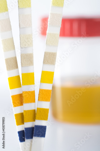 Urine test strip against a urine sample on a white background (vertical, horizontal)