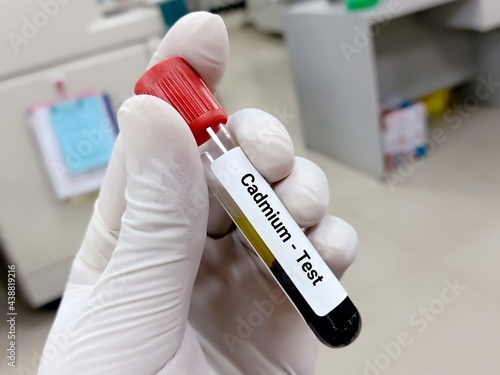 Test Tube with blood sample for Cadmium (CD) test. Large amounts of cadmium can damage the kidney, liver, and heart. A medical testing concept in the laboratory background. photo