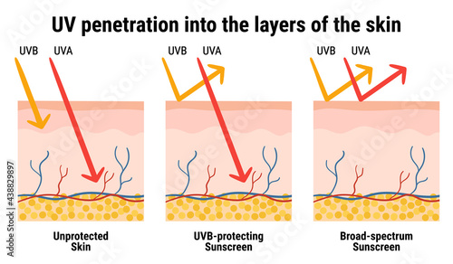 UV penetration into the layers of the skin. Infographic of sunscreen protection against UVA, UVB rays. Skin anatomy. Broad-spectrum sunscreen. Hand drawn vector illustration.