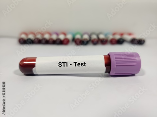 Test Tube with blood sample for STI (sexually transmitted infection) test. photo