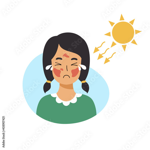 Girl is crying because of  sunburn on her face. Sad child with skin damage.