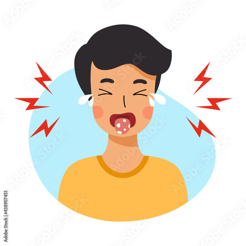 Сhild has stomatitis in mouth. Diseases of oral cavity. Candidiasis in boy.
