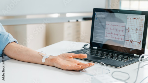 Wallpaper Mural Biofeedback - Female hand with attached sensors for heart rate measurement. Torontodigital.ca