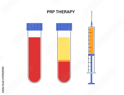 Platelet rich plasma concept