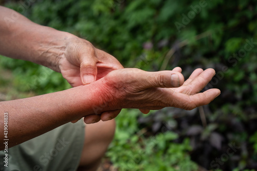 Closeup of senior hands with hand pain in palm and massage his self