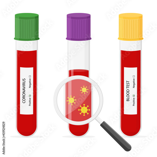 Glass tube with blood for detail test on covid-19, coronavirus with magnifier. Positive test. Blood sample. Virus analysis for laboratory. Vector illustration on white background.
