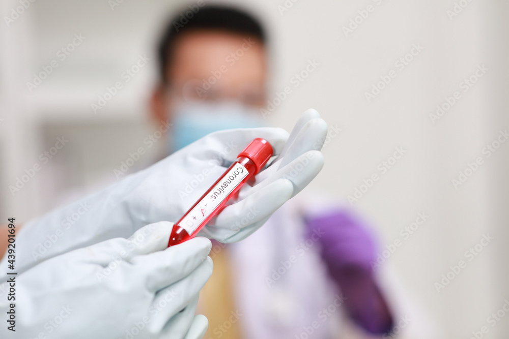 Nurse or Doctor hand with Medical gloves hold Sample blood from Patient 's corona virus (Covid-19) MR 20-062 Nurse or Doctor hand with Medical gloves hold Sample blood from Patient 's corona virus (Covid-19) MR 20-062