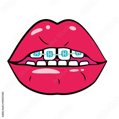 Red open mouth with braces on Teeth