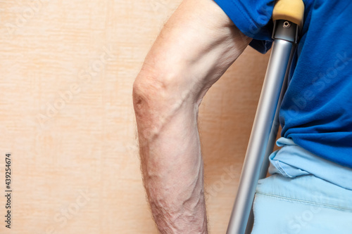 Medical Concepts and Ideas. Closeup of Man Holding Crutches Under His Hand.