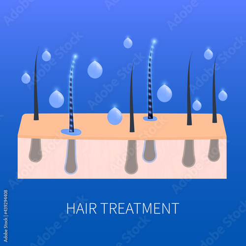 Hair follicle premium treatment and strengthening nourishing concept. Scalp cure with collagen serum and vitamin ingredients. Medical diagnostics symbol. Vector illustration..