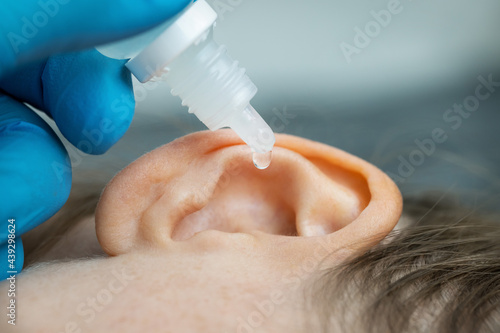 doctor dripping ear drops into patient ear. ear pain and clogged ears concept photo