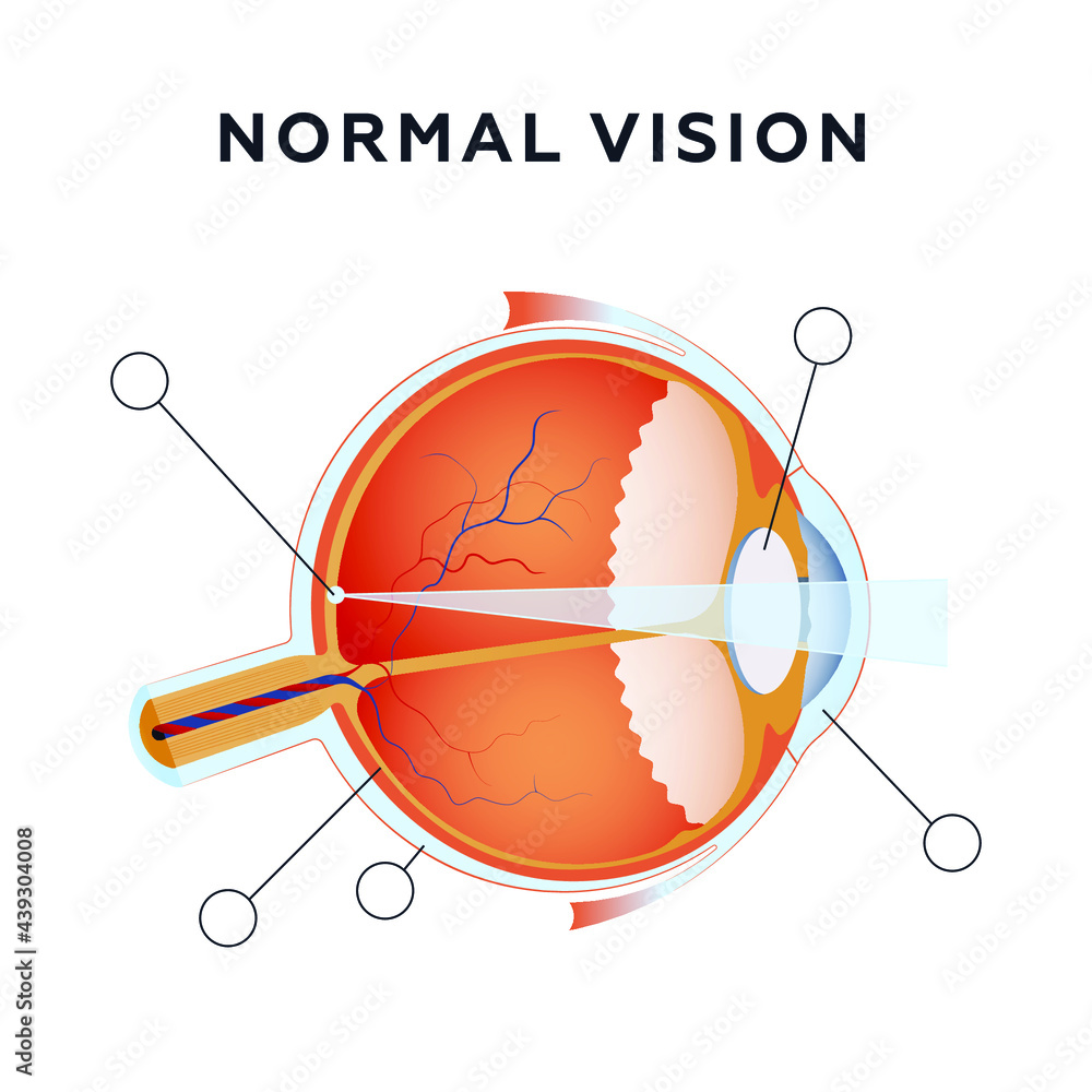 Normal Eye Vision. Modern Flat Vector Illustration. Detailed Anatomy of the Healthy Eye. Website Banner. Social Media Template. Normal Eye Vision. Modern Flat Vector Illustration. Detailed Anatomy of the Healthy Eye. Website Banner. Social Media Template.